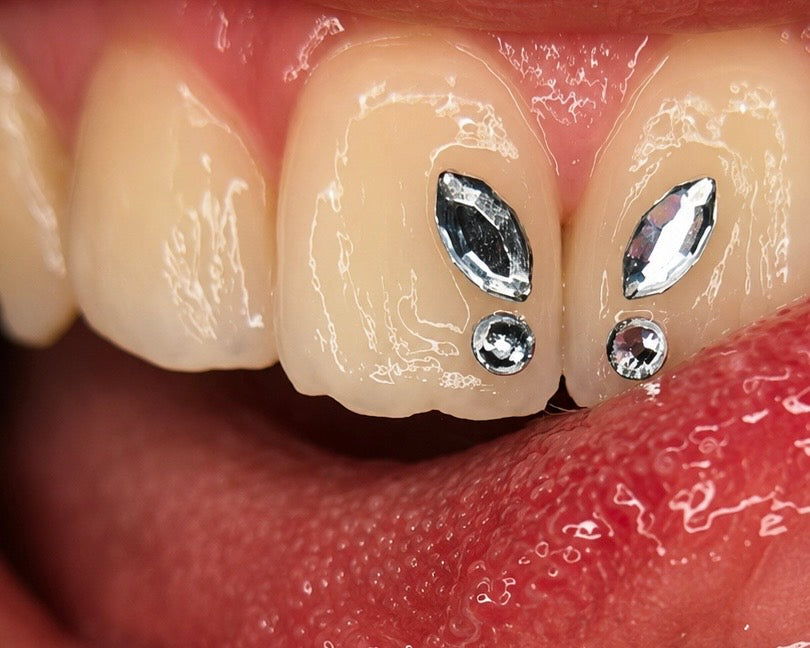 Máster de joyería dental